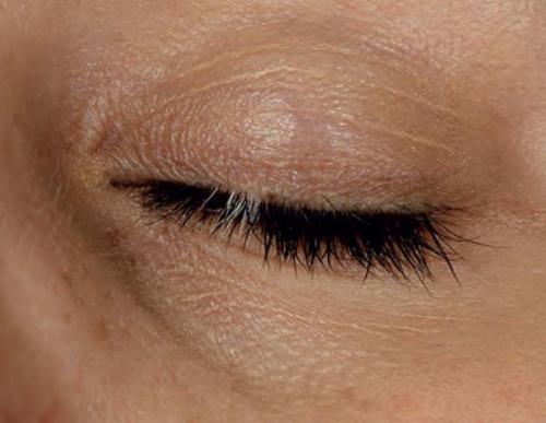 Причины появления пигментных пятен на теле. Виды пигментных пятен 02 Причины появления пигментных пятен на теле. Виды пигментных пятен 02