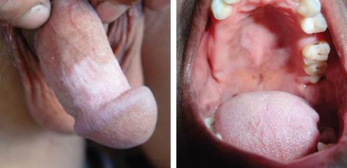 Средства от пигментных пятен на руках. Причины пигментных пятен на руках 10