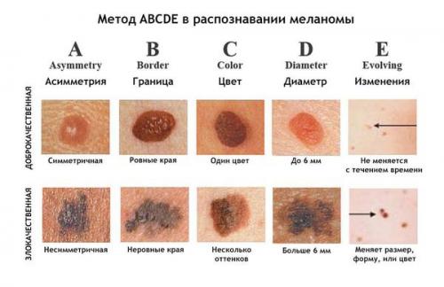 Изменение состояния И цвета кожи. Характеристика тусклого цвета лица 01
