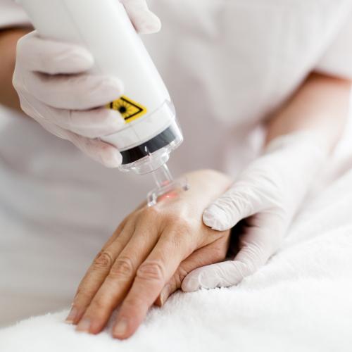 Причины возникновения пигментных пятен на кистях рук. Пигментация на кистях рук 01