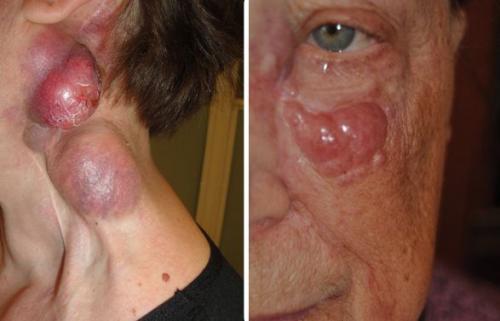 Изменение состояния И цвета кожи. Характеристика тусклого цвета лица 02