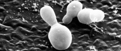 Себорейный дерматит на голове. Дерматит головы: причины, симптомы, методы лечения 04