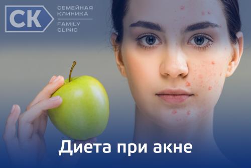 Какие продукты полезны при акне. Принципы диеты от прыщей 04 Какие продукты полезны при акне. Принципы диеты от прыщей 04