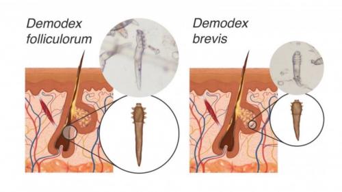 ФАРМАТЕКА » Принципы терапии демодекоза. Лечение демодекоза глаз 01 ФАРМАТЕКА » Принципы терапии демодекоза. Лечение демодекоза глаз 01