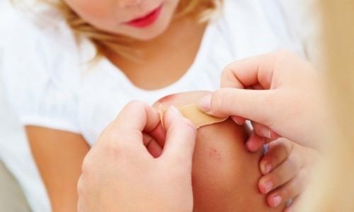 Аптечные средства для регенерации кожи. Как можно ускорить заживление ран