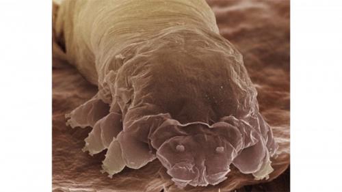 Демодекоз лечение на лице. Клещ демодекс на лице и глазах 02