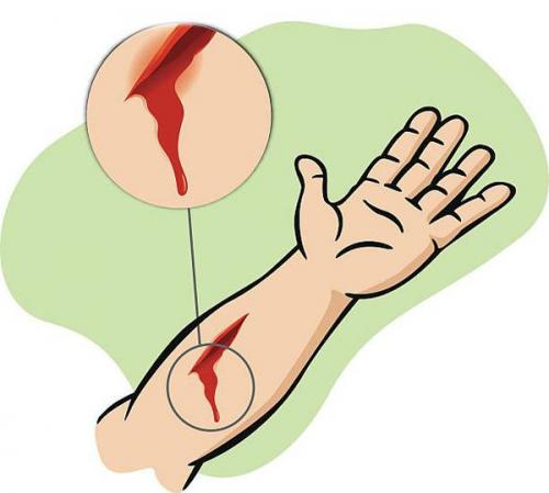 Как можно ускорить заживление ран. 10 лучших мазей для заживления ран на коже 10 Как можно ускорить заживление ран. 10 лучших мазей для заживления ран на коже 10