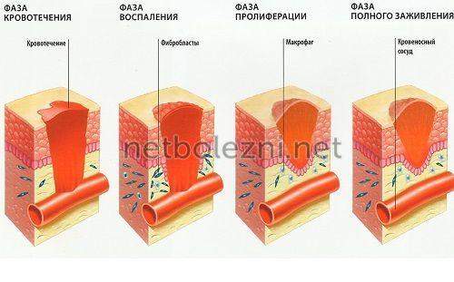 Как можно ускорить заживление ран. 10 лучших мазей для заживления ран на коже 01 Как можно ускорить заживление ран. 10 лучших мазей для заживления ран на коже 01
