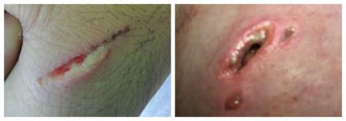 Как можно ускорить заживление ран. 10 лучших мазей для заживления ран на коже 12 Как можно ускорить заживление ран. 10 лучших мазей для заживления ран на коже 12