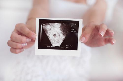 Почему нельзя делать аборт. Течение аборта