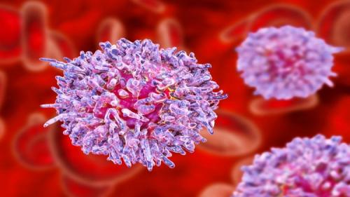 10 первых симптомов лейкемии. Как проявляется лейкоз (лейкемия, белокровие, рак крови) на ранних стадиях 03