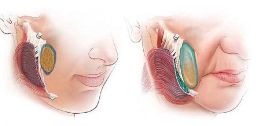 Как вернуть здоровье и свежесть кожи в домашних условиях. Землистый цвет лица: возвращаем коже красоту 02