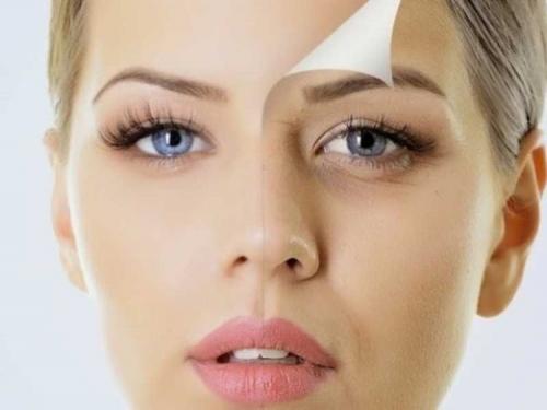 Пилинг от пигментных пятен. Химический, или кислотный 04