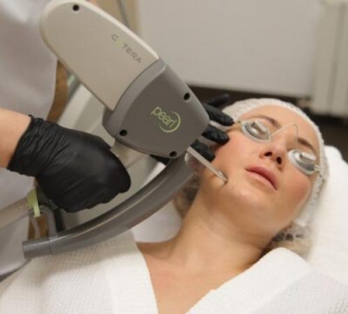 Как убрать пигментацию в домашних условиях. Как убрать пигментные пятна на лице с помощью косметологических процедур