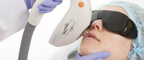 Я избавилась пигментных пятен лице. Что выбрать - крем, IPL, лазерные шлифовки или химические пилинги?