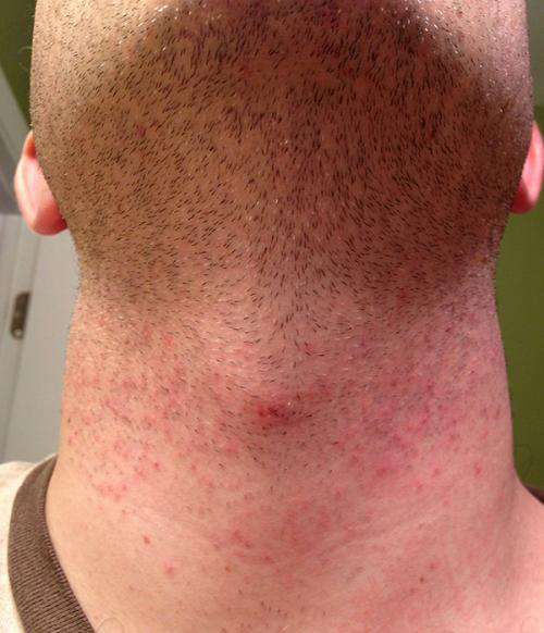 Роторная электробритва vs сеточная. Особенности сетчатой электробритвы