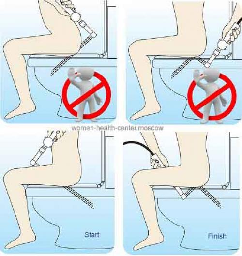 Как правильно делать спринцевания в домашних условиях. Как правильно спринцеваться: советы и рекомендации 03