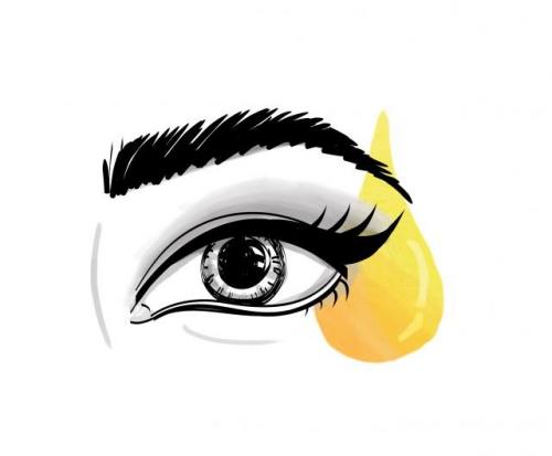 Проблемы после наращивания ресниц. Как восстановить ресницы после наращивания?