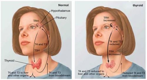 Щитовидная железа: основные функции и заболевания 04