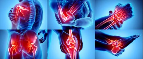 Нам не страшен артроз кистей рук. Физико-химические свойства хрящевой ткани могут изменяться также в результате следующих заболеваний: 01 Нам не страшен артроз кистей рук. Физико-химические свойства хрящевой ткани могут изменяться также в результате следующих заболеваний: 01