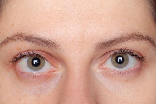 ТОП 15 лучших консилеров от кругов под глазами. ТОП 10 лучших консилеров от кругов под глазами: какой выбрать, отзывы 32 ТОП 15 лучших консилеров от кругов под глазами. ТОП 10 лучших консилеров от кругов под глазами: какой выбрать, отзывы 32