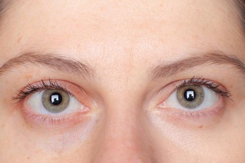 ТОП 15 лучших консилеров от кругов под глазами. ТОП 10 лучших консилеров от кругов под глазами: какой выбрать, отзывы 26 ТОП 15 лучших консилеров от кругов под глазами. ТОП 10 лучших консилеров от кругов под глазами: какой выбрать, отзывы 26