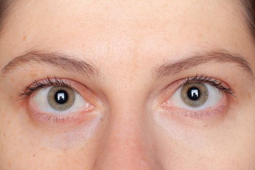 ТОП 15 лучших консилеров от кругов под глазами. ТОП 10 лучших консилеров от кругов под глазами: какой выбрать, отзывы 28 ТОП 15 лучших консилеров от кругов под глазами. ТОП 10 лучших консилеров от кругов под глазами: какой выбрать, отзывы 28