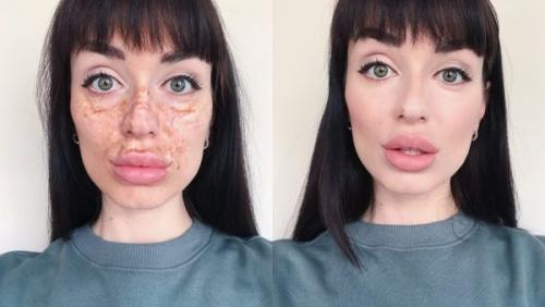 Как зеленый консилер Seventeen Anticernes помогает скрыть пигментные пятна на лице. Ровный тон лица: маскируем пигментные пятна корректорами и консилерами