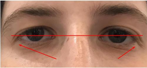 Какой макияж подходит тебе по форме глаз. Как подобрать стрелки по форме глаз и лица и понять, какие тебе подходят?