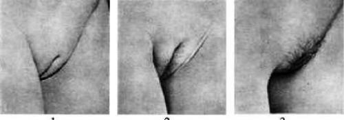 Стрижка интимных зон: как сделать это дома 10