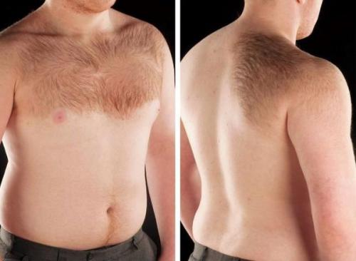 Пигментные пятна почему появляются и как избавиться. Пигментация на лице 03 Пигментные пятна почему появляются и как избавиться. Пигментация на лице 03