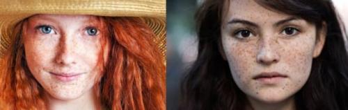 Пигментные пятна почему появляются и как избавиться. Пигментация на лице 12 Пигментные пятна почему появляются и как избавиться. Пигментация на лице 12