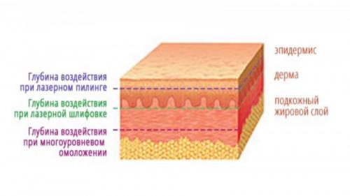 Как убрать пигментные возрастные пятна на руках. Пигментация на руках: как избавиться 02 Как убрать пигментные возрастные пятна на руках. Пигментация на руках: как избавиться 02