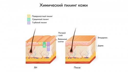 Как убрать пигментные возрастные пятна на руках. Пигментация на руках: как избавиться 03 Как убрать пигментные возрастные пятна на руках. Пигментация на руках: как избавиться 03