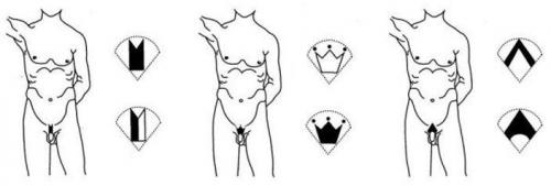 Что такое интимные стрижки