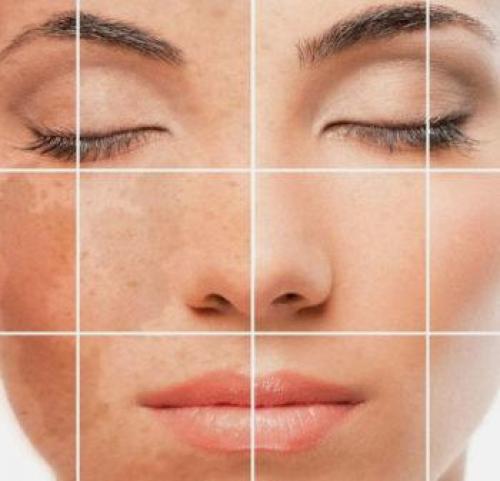 Коричневые пятна на ногах, как веснушки. Пигментные пятна на лице, руках и ногах