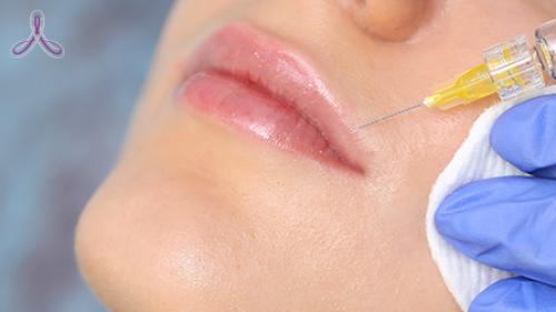 Как убрать кисетные морщины. Кисетные морщины 01