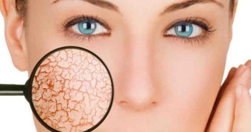 Шелушащаяся кожа на лице. Причины шелушения – внешние факторы и неправильный уход