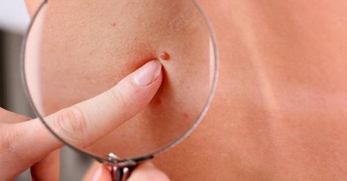 Какие бывают формы глаз и макияж под них. Какие бывают формы глаз? 16