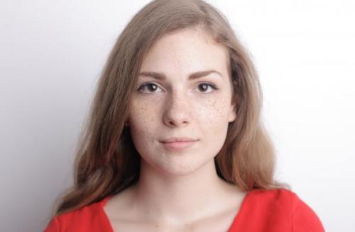 Почему появляется пигментация на коже и как от нее избавиться. Причины появления пигментных пятен 04 Почему появляется пигментация на коже и как от нее избавиться. Причины появления пигментных пятен 04