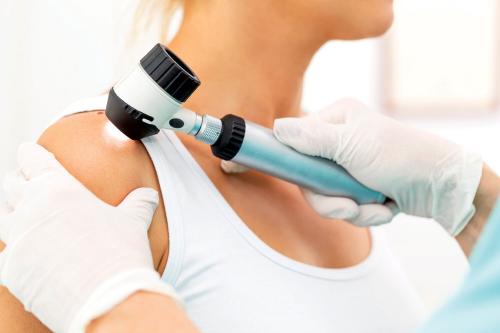 Что такое себорейный кератоз. Себорейный кератоз кожи: лечение