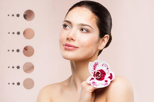 Гиперпигментация кожи на лице и теле. Виды и симптомы пигментных пятен 05