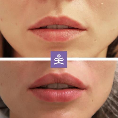 Это уже не модно. Устаревшие бьюти-процедуры: что не модно в 2021 02