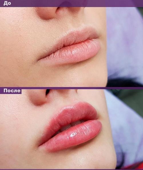 Это уже не модно. Устаревшие бьюти-процедуры: что не модно в 2021 01