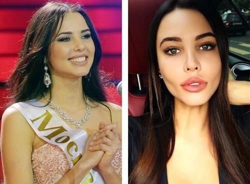 Это уже не модно. Устаревшие бьюти-процедуры: что не модно в 2021 04