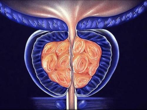 Топ-6 запретов при простатите. Чем же питание при простатите отличается от обычного меню? 03