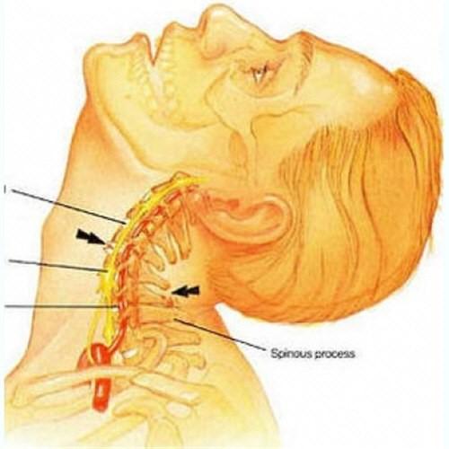 10 причин боли в спине в области поясницы. Болит спина в области поясницы 05